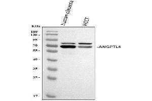 Western blot analysis of ANGPTL4 using anti-ANGPTL4 antibody (ABIN5518734). (ANGPTL4 anticorps  (C-Term))