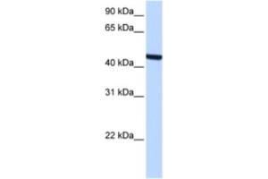 Western Blotting (WB) image for anti-Zinc Finger, C3HC-Type Containing 3 (ZCCHC3) antibody (ABIN2463365) (ZCCHC3 anticorps)