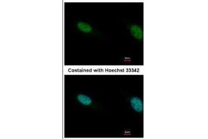 ICC/IF Image Immunofluorescence analysis of paraformaldehyde-fixed HeLa, using PB1, antibody at 1:500 dilution.
