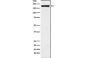 Western blot analysis of MRC2/ENDO180 expression in Saos2 cell lysate.