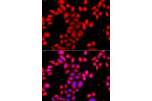 Immunofluorescence analysis of A549 cell using OSGEPL1 antibody. (OSGEPL1 anticorps)