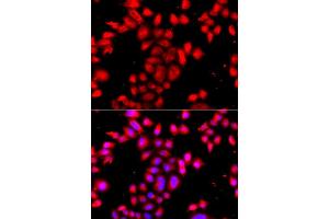 Immunofluorescence analysis of A549 cell using OSGEPL1 antibody. (OSGEPL1 anticorps)