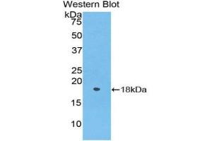 Western blot analysis of the recombinant protein. (Periostin anticorps  (AA 24-173))