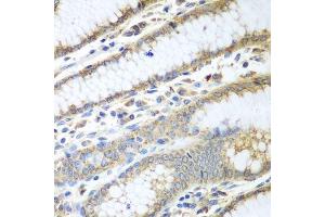 Immunohistochemistry of paraffin-embedded human stomach using PDIA3 antibody.