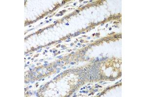 Immunohistochemistry of paraffin-embedded human stomach using PDIA3 antibody. (PDIA3 anticorps  (AA 206-505))