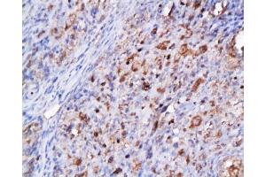 Immunohistochemistry (Paraffin-embedded Sections) (IHC (p)) image for anti-Cyclin-Dependent Kinase 2 (CDK2) (AA 1-100) antibody (ABIN2172819) (CDK2 anticorps  (AA 1-100))