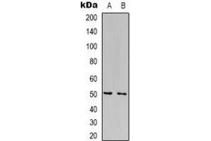 Western blot analysis of FOXN4 expression in Jurkat (A), HepG2 (B) whole cell lysates.
