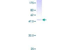 Image no. 1 for Twisted Gastrulation Homolog 1 (TWSG1) (AA 1-223) protein (GST tag) (ABIN1324209)