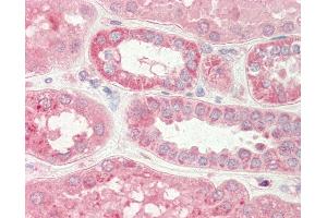 Human Kidney: Formalin-Fixed, Paraffin-Embedded (FFPE) (Stim2 anticorps  (N-Term))