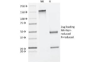 SDS-PAGE Analysis Purified Cytokeratin 8 Mouse Monoclonal Antibody (C-43).