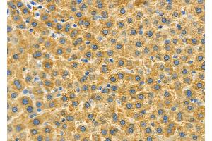 ABIN6262577 and ABIN6279542 at 1/100 staining Rat liver tissue by IHC-P. (IMMP2L anticorps  (Internal Region))