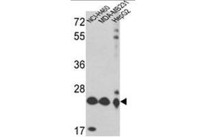 Western blot analysis of PRDX3 Antibody (Peroxiredoxin 3 anticorps  (N-Term))