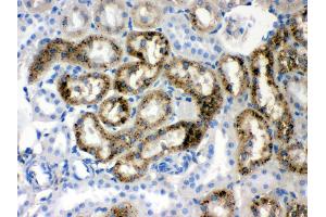 Anti- Prealbumin Picoband antibody,IHC(P) IHC(P): Rat Kidney Tissue (TTR anticorps  (AA 21-147))