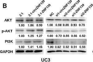 ZNF139 and its circRNA (circZNF139) activates PI3K/AKT signaling pathway in BC cells. (GAPDH anticorps)