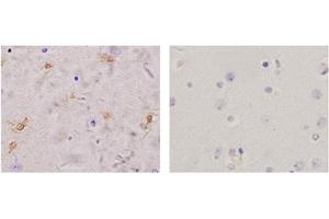 Immunohistochemistry analysis of human brain tissue slide (Paraffin embedded) using Rabbit Anti-Glutamine Synthetase Polyclonal Antibody (Left, ABIN398821) and Purified Rabbit IgG (Whole molecule) Control (Right, ABIN398653)