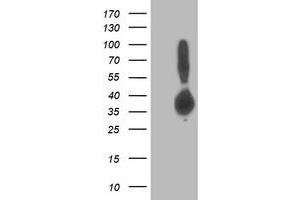 Western Blotting (WB) image for anti-Aldolase B, Fructose-Bisphosphate (ALDOB) antibody (ABIN1496608)
