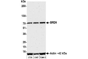 Western Blotting (WB) image for anti-Bromodomain Containing 9 (BRD9) (AA 547-597) antibody (ABIN7455162) (Recombinant BRD9 anticorps  (AA 547-597))