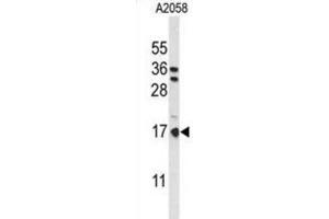 Western Blotting (WB) image for anti-Parathymosin (PTMS) antibody (ABIN3004110) (Parathymosin anticorps)