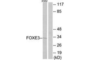 Western Blotting (WB) image for anti-Forkhead Box E3 (FOXE3) (AA 81-130) antibody (ABIN2889577) (FOXE3 anticorps  (AA 81-130))