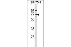 C10orf2 Antibody (C-term) (ABIN656726 and ABIN2845951) western blot analysis in ZR-75-1 cell line lysates (35 μg/lane). (C10orf2 anticorps  (C-Term))
