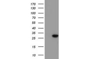 Western Blotting (WB) image for anti-Bridging Integrator 3 (BIN3) antibody (ABIN1496925) (BIN3 anticorps)