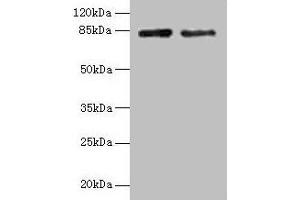 Western blot All lanes: HJURP antibody at 12 μg/mL Lane 1: Jurkat whole cell lysate Lane 2: Hela whole cell lysate Secondary Goat polyclonal to rabbit IgG at 1/10000 dilution Predicted band size: 84, 78, 75 kDa Observed band size: 84 kDa (HJURP anticorps  (AA 1-748))