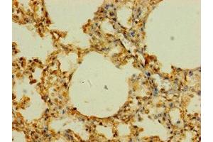 Immunohistochemistry of paraffin-embedded human lung tissue using ABIN7170255 at dilution of 1:100 (SLC43A3 anticorps  (AA 209-278))