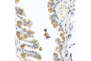 Immunohistochemistry of paraffin-embedded mouse lung using CHI3L2 antibody at dilution of 1:100 (40x lens). (CHI3L2 anticorps)