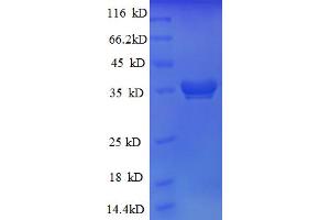 SDS-PAGE (SDS) image for Ribosomal Protein L28 (RPL28) (AA 2-78) protein (GST tag) (ABIN5712638)