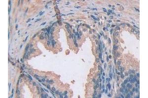 Detection of ATXN10 in Human Prostate Tissue using Polyclonal Antibody to Ataxin 10 (ATXN10)