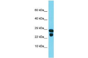 Western Blotting (WB) image for anti-IdnK Gluconokinase Homolog (IDNK) (Middle Region) antibody (ABIN2790936) (IdnK anticorps  (Middle Region))