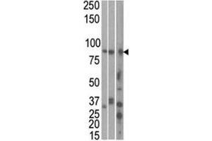 The MARK1 antibody used in western blot to detect MARK1 in HeLa, T47D, and mouse brain cell line/ tissue lysate (left to right) (MARK1 anticorps  (AA 671-700))