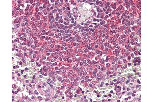 Anti-NF-KappaB p105 antibody IHC of human spleen.