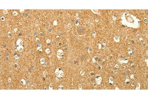 Immunohistochemistry of paraffin-embedded Human brain tissue using EDG7 Polyclonal Antibody at dilution 1:40