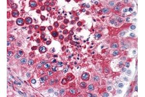 Image no. 1 for anti-Reticulon 4 (RTN4) (N-Term) antibody (ABIN372912)