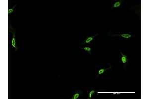 Immunofluorescence of monoclonal antibody to CPSF6 on HeLa cell.