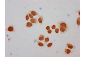 Immunocytochemistry analysis of ABIN7139590 diluted at 1:30 and staining in Hela cells performed on a Leica BondTM system.
