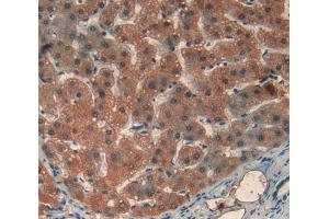 Used in DAB staining on fromalin fixed paraffin- embedded liver tissue