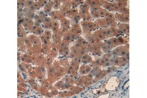 Used in DAB staining on fromalin fixed paraffin- embedded liver tissue (Transferrin Receptor 2 anticorps  (AA 493-785))
