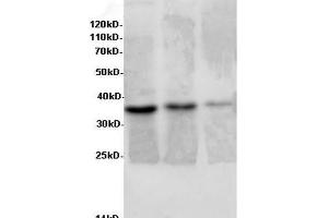 Western Blot analysis of Rat liver, Rat lung tissue and Jurkat cells using AIMP2 Polyclonal Antibody at dilution of 1:600