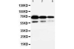 Anti-CD34 antibody, Western blotting Lane 1: Recombinant Human CD34 Protein 10ng Lane 2: Recombinant Human CD34 Protein 5ng Lane 3: Recombinant Human CD34 Protein 2.