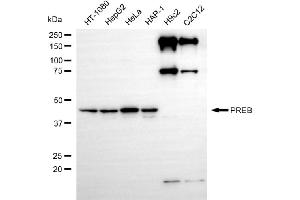 Western blotting analysis using PREB antibody (ABIN7799913). (Recombinant PREB anticorps)