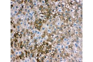 IHC-P: FABP1 antibody testing of rat liver tissue (FABP1 (liver) anticorps  (N-Term))
