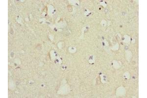 Immunohistochemistry of paraffin-embedded human brain tissue using ABIN7159842 at dilution of 1:100