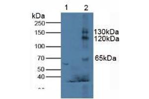 Figure. (Klotho anticorps  (AA 516-955))