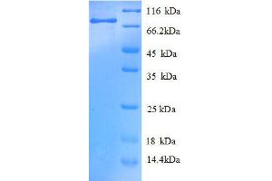 Keratin 8 (KRT8) (AA 2-483), (full length) protein (GST tag)