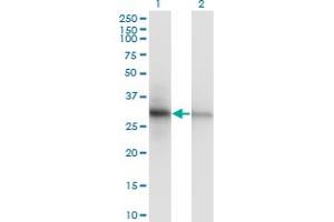 Western Blot analysis of PCNA expression in transfected 293T cell line by PCNA monoclonal antibody (M04), clone S1. (PCNA anticorps  (AA 1-261))