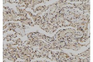 ABIN6278135 at 1/100 staining Human lung tissue by IHC-P. (Annexin IV anticorps  (Internal Region))