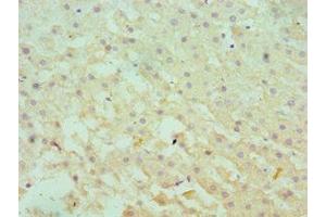 Immunohistochemistry of paraffin-embedded human liver tissue using ABIN7166366 at dilution of 1:100