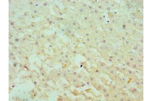 Immunohistochemistry of paraffin-embedded human liver tissue using ABIN7166366 at dilution of 1:100 (SERPINA1 anticorps  (AA 165-444))